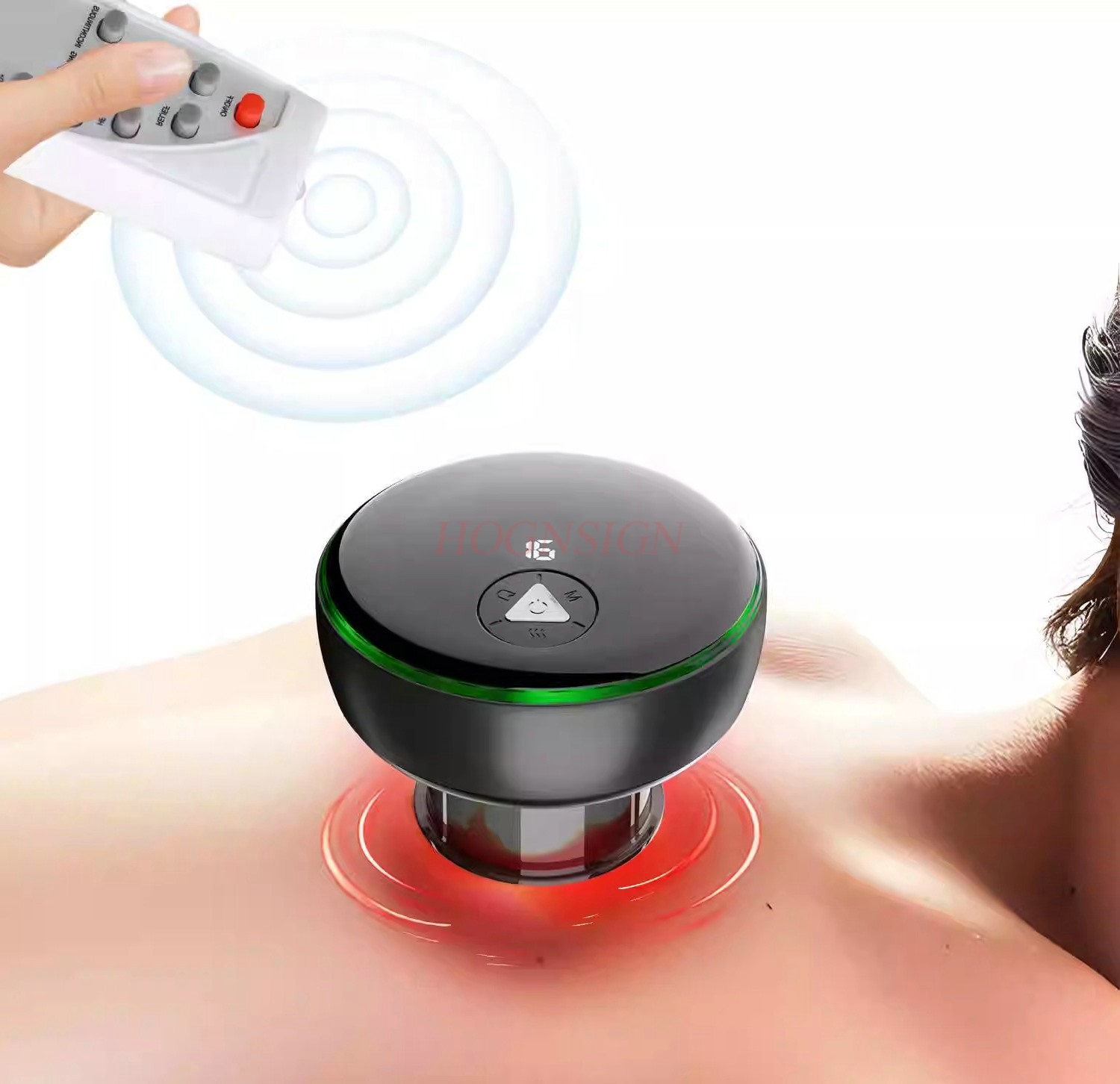 Cupping Therapy Set - 1pcs Wireless Remote Electric Smart Dynamic
