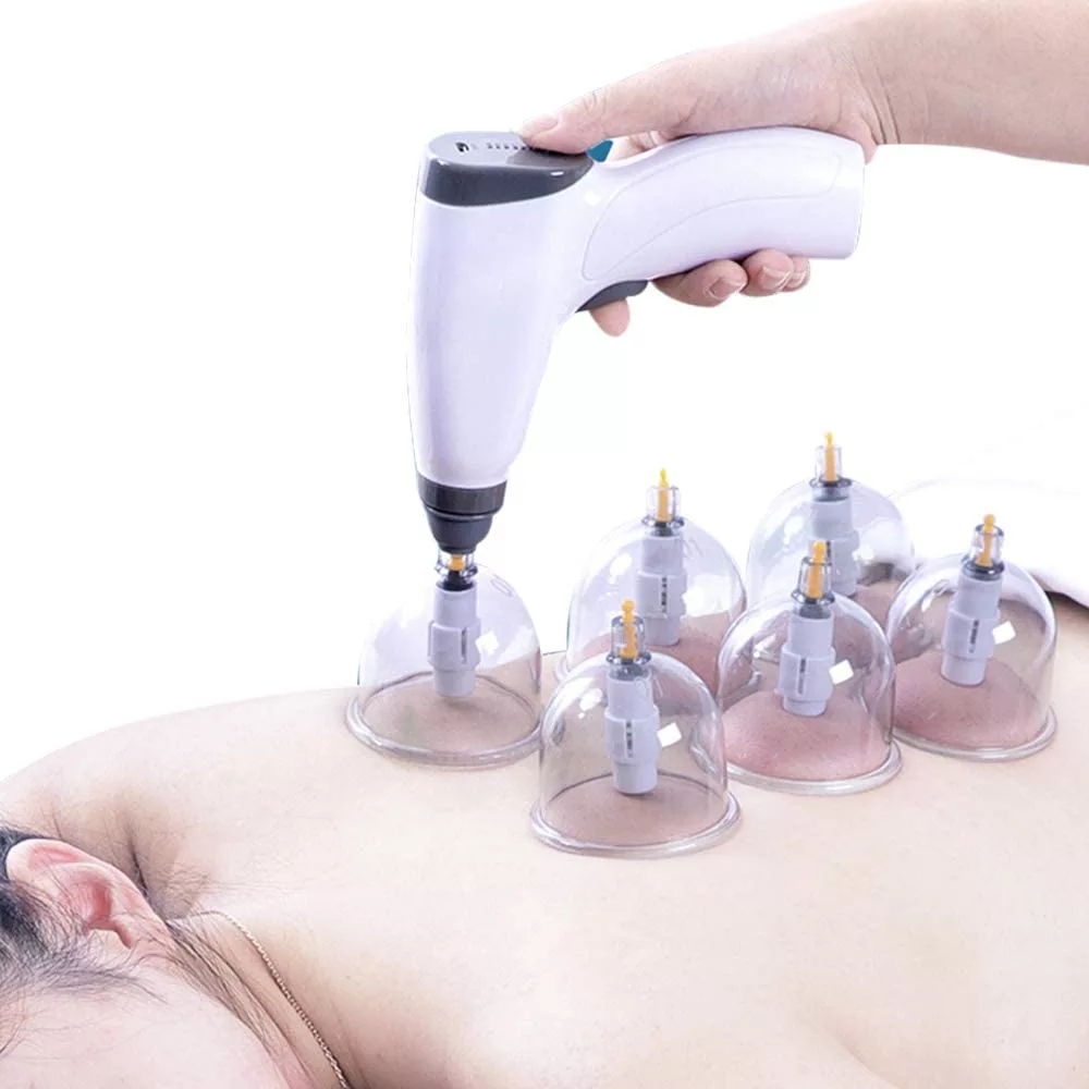 Suction Cup AntiCellulite Elec - Cupping Therapy Set ulasan dan harga