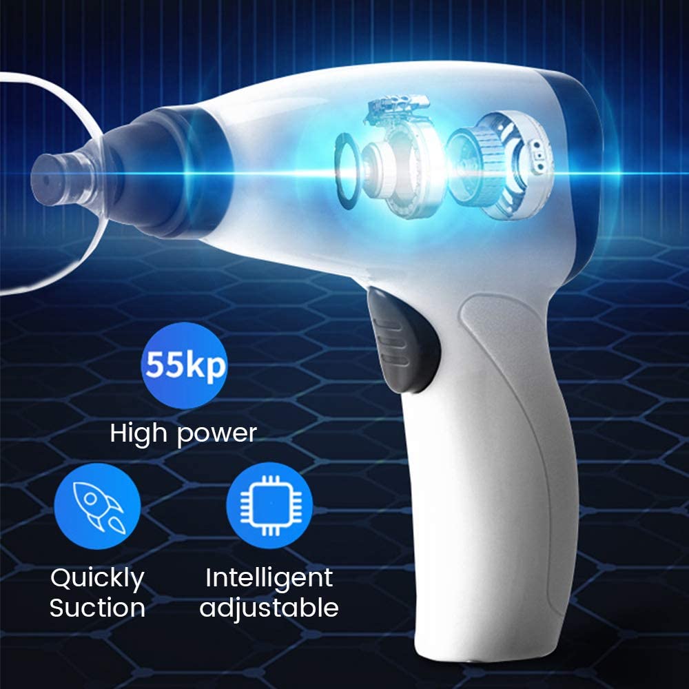 Suction Cup AntiCellulite Elec - Cupping Therapy Set ulasan dan harga