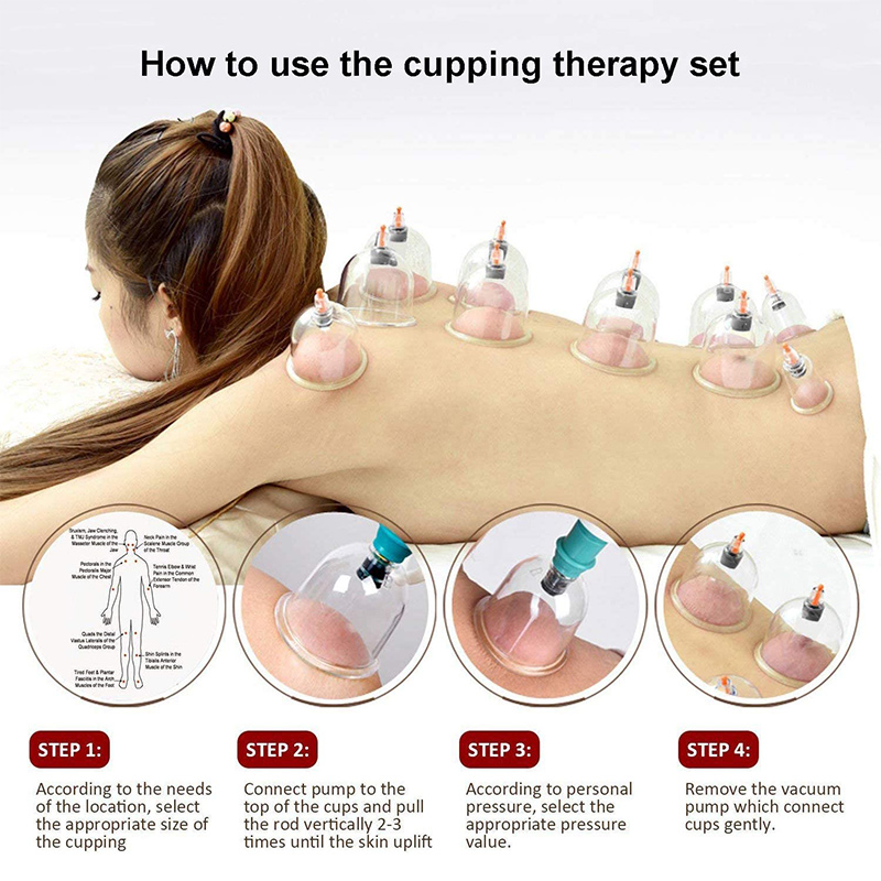 6or24  Pieces Suction Cups Mas - Cupping Therapy Set ulasan dan harga