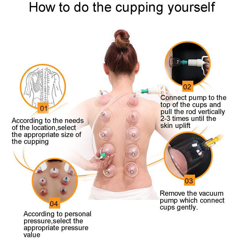 6or24  Pieces Suction Cups Mas - Cupping Therapy Set ulasan dan harga