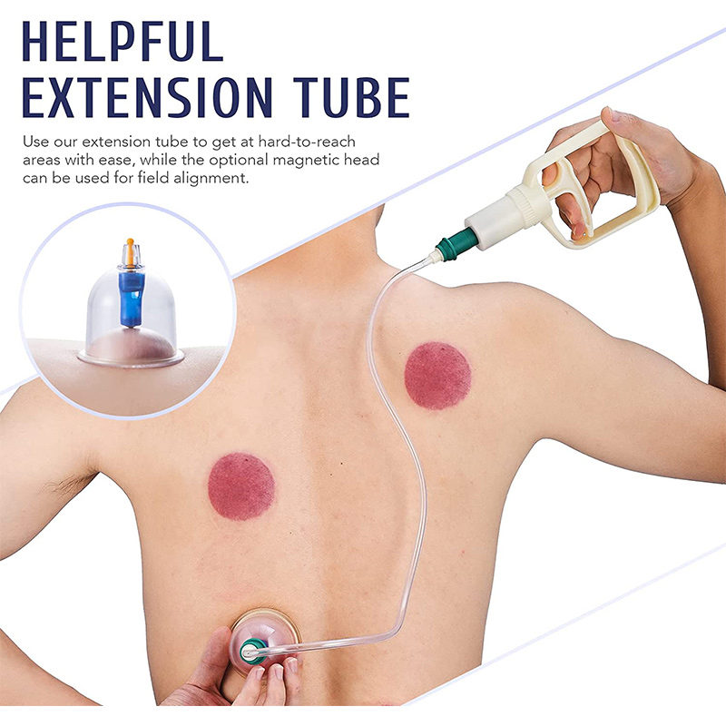 6or24  Pieces Suction Cups Mas - Cupping Therapy Set ulasan dan harga