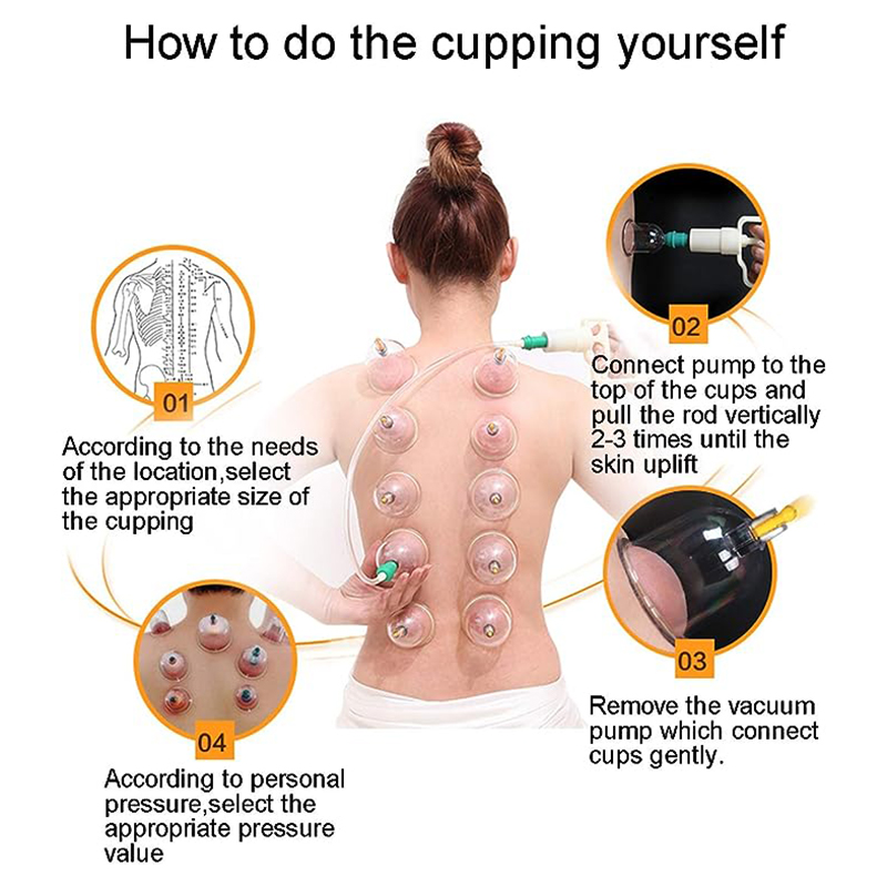 24 Cans JINGKANG Chinese Vacuu - Cupping Therapy Set ulasan dan harga